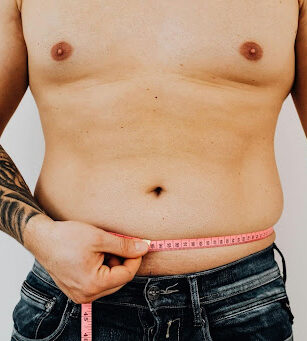 Is Male Liposuction Right for You? What Dr. Steinbrech Wants Chicago Men to Know