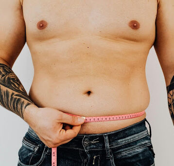 Is Male Liposuction Right for You? What Dr. Steinbrech Wants Chicago Men to Know