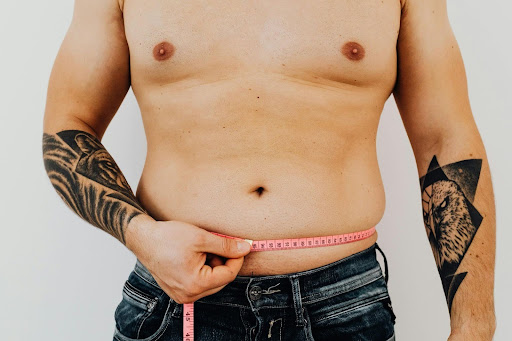 Is Male Liposuction Right for You? What Dr. Steinbrech Wants Chicago Men to Know